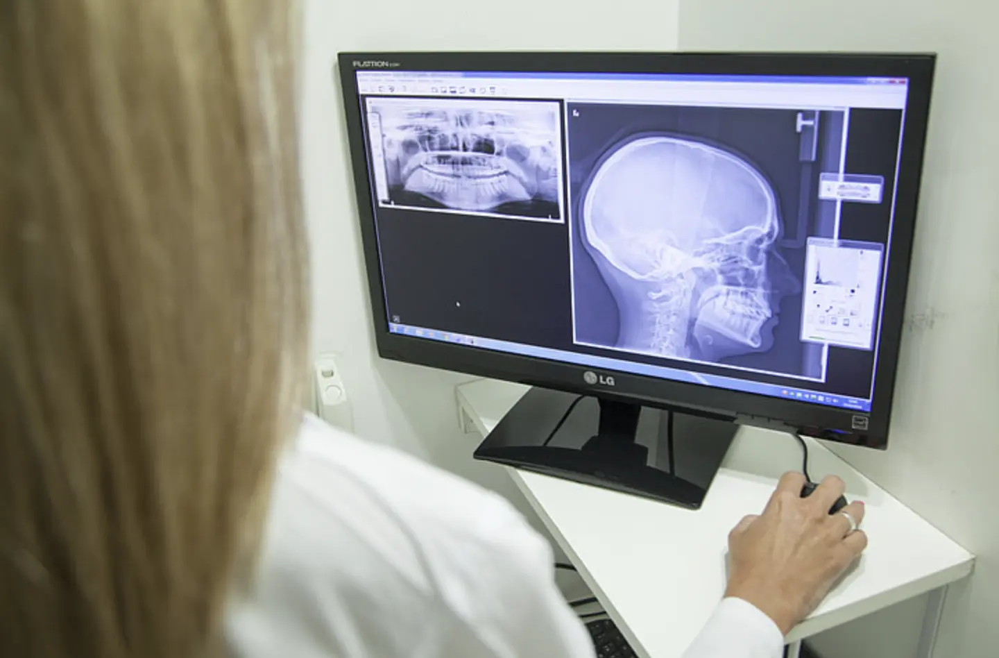 Strumento AI Accelera l&rsquo;Analisi delle Immagini Mediche